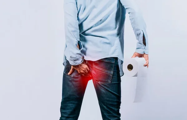 Piles and Hemorrhoids